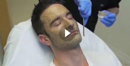 Melasma Treatment