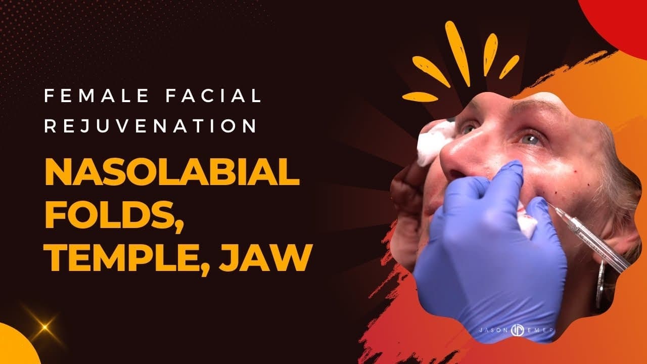 Watch a temple augmentation procedure video