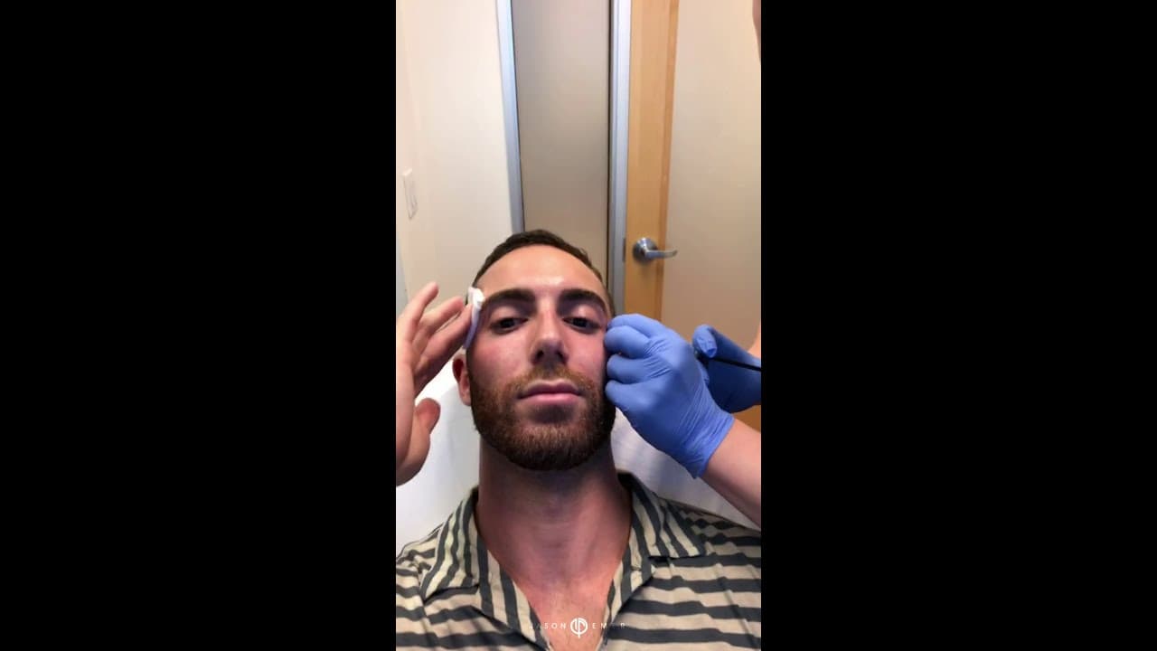 Watch a temple augmentation procedure video