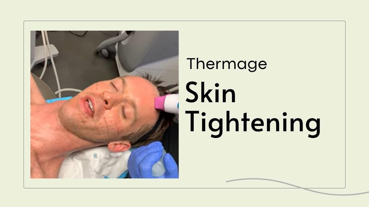 Watch a thermage non-surgical radiofrequency therapy procedure video