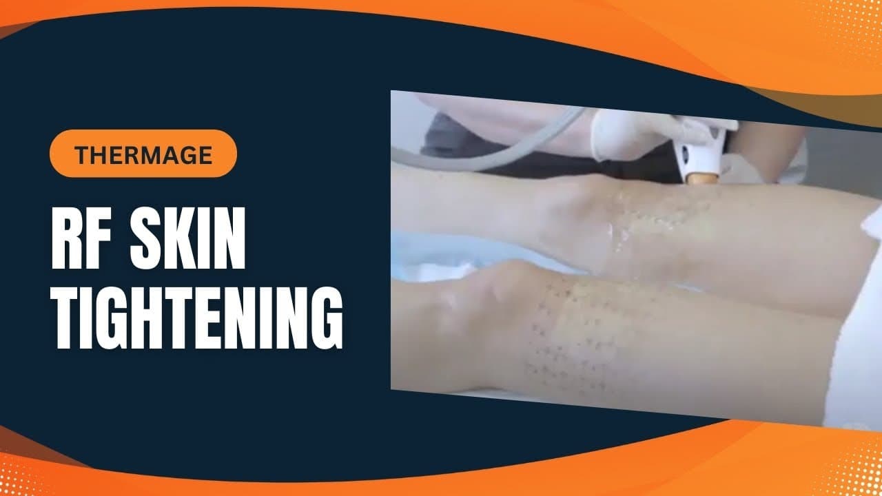 Watch a thermage non-surgical radiofrequency therapy procedure video