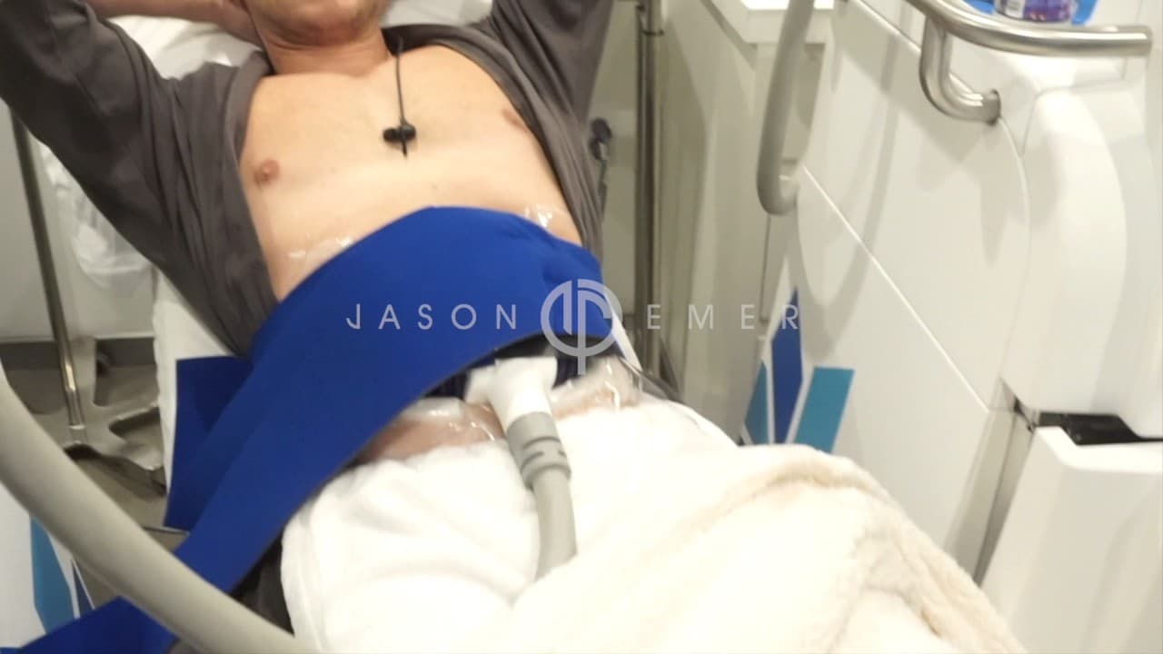 Watch a coolsculpting for freezing fat away procedure video
