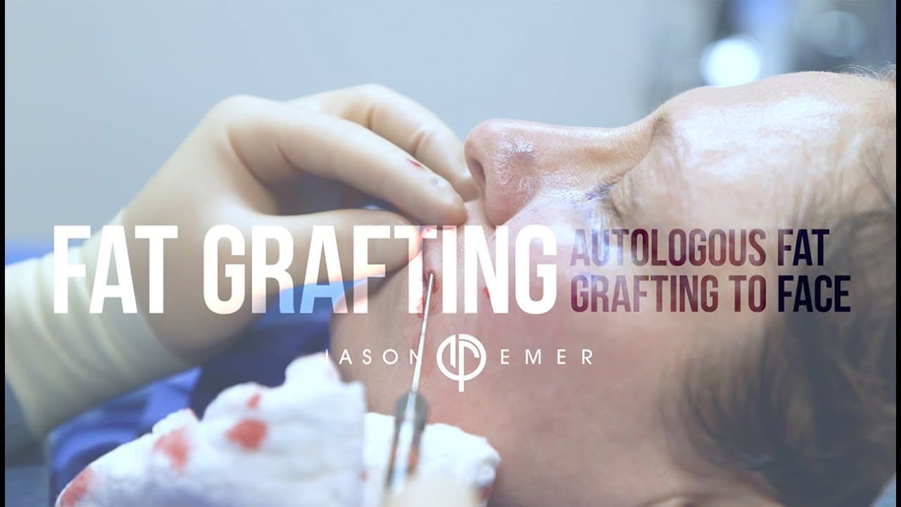 Watch a temple augmentation procedure video
