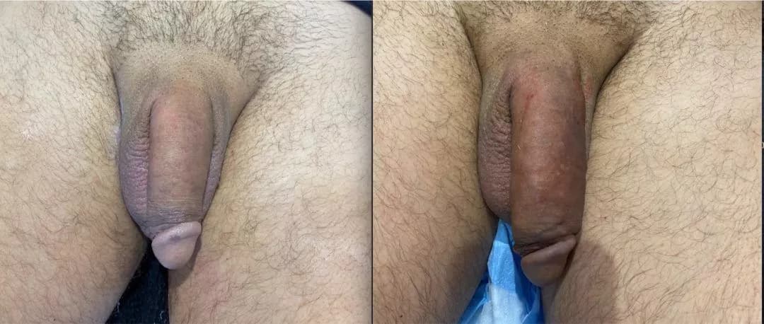 Patient 240220