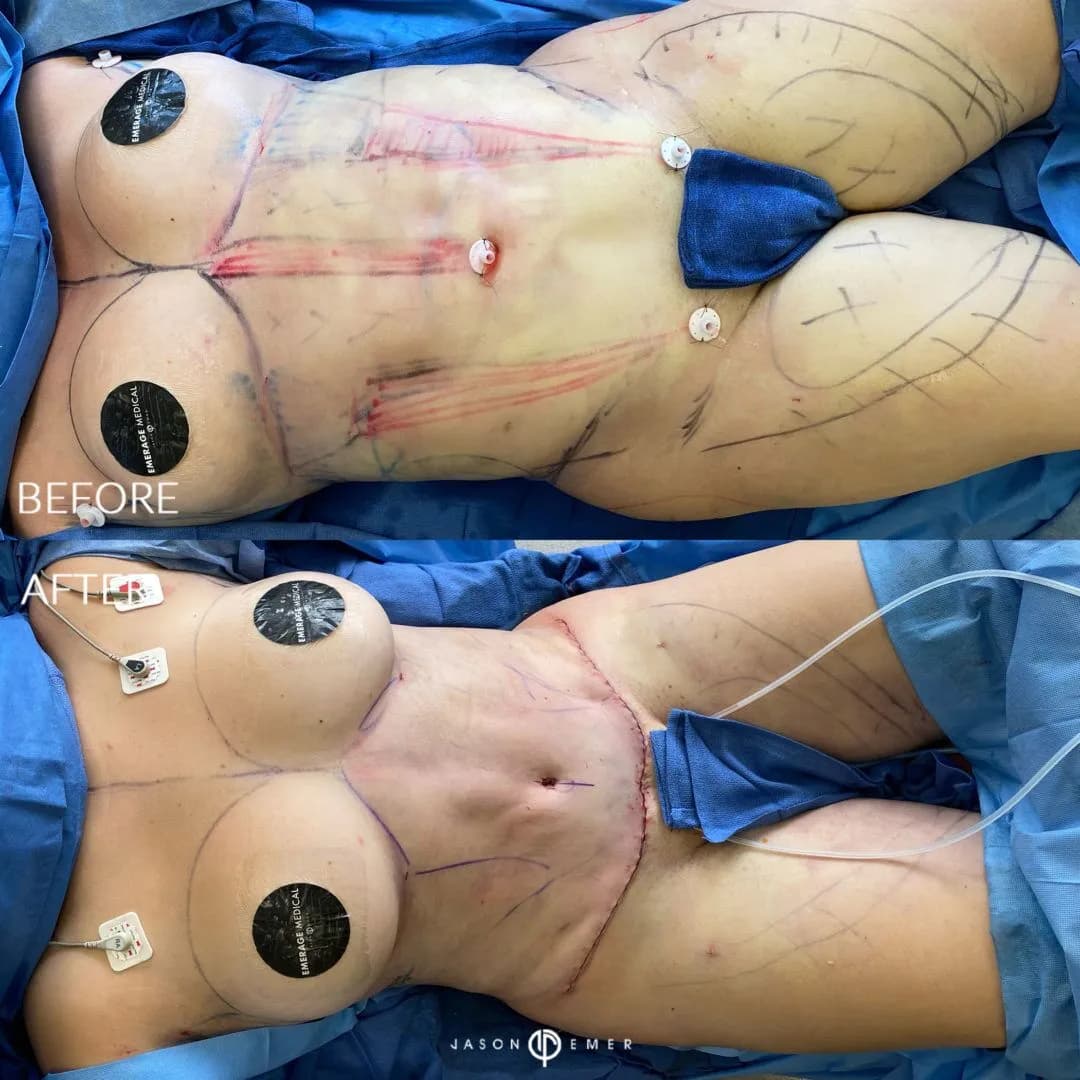 Patient 241517