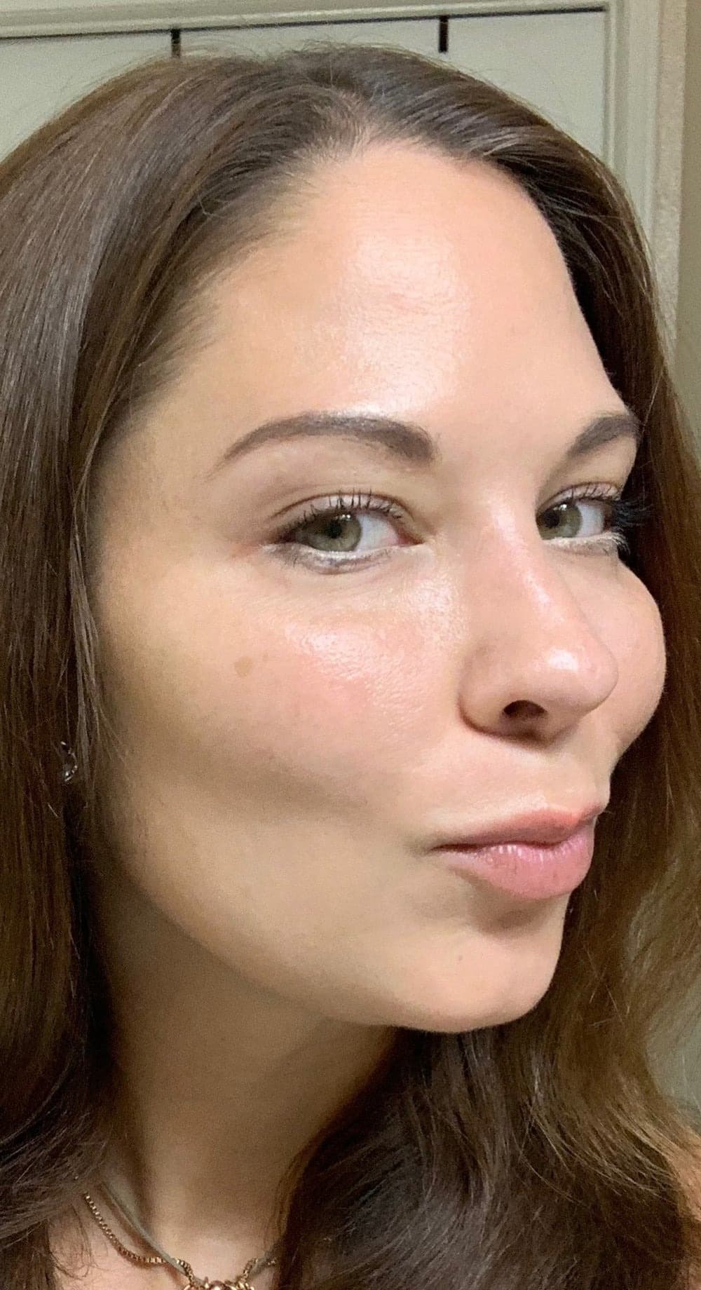 CELESTA Facial Sculpting — After