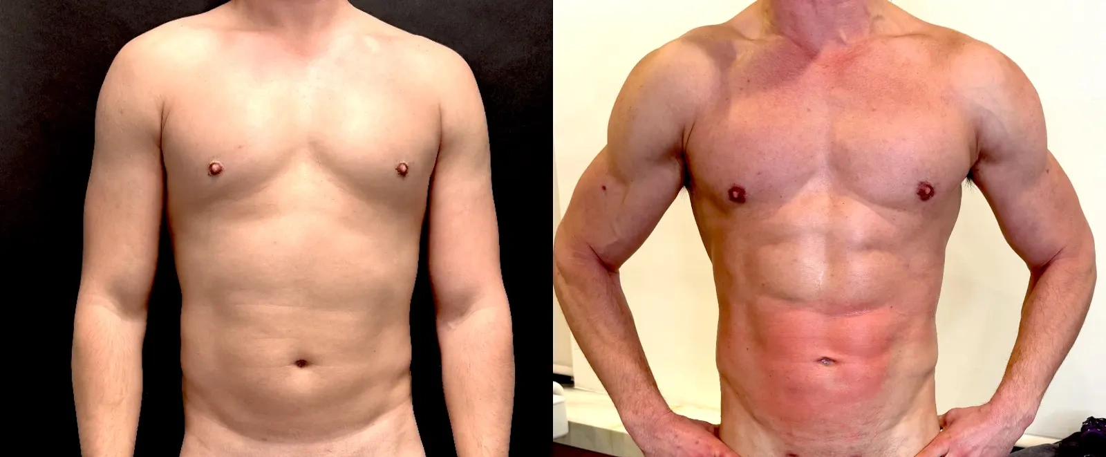 Gregg Starr — Torso / original comparison from the practice image archive