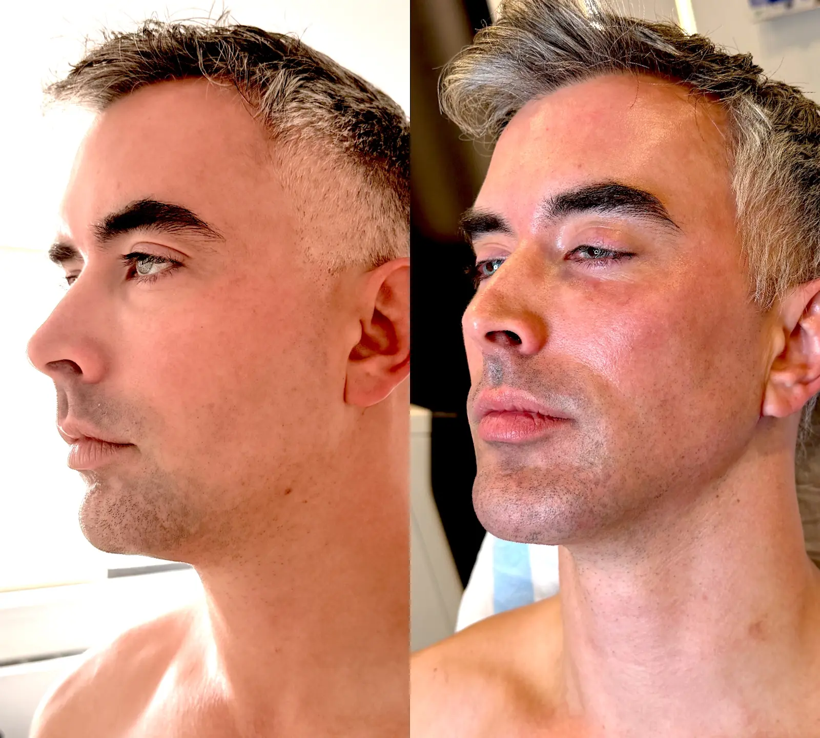 Gregg Starr — Face / opposite three-quarter from the practice image archive