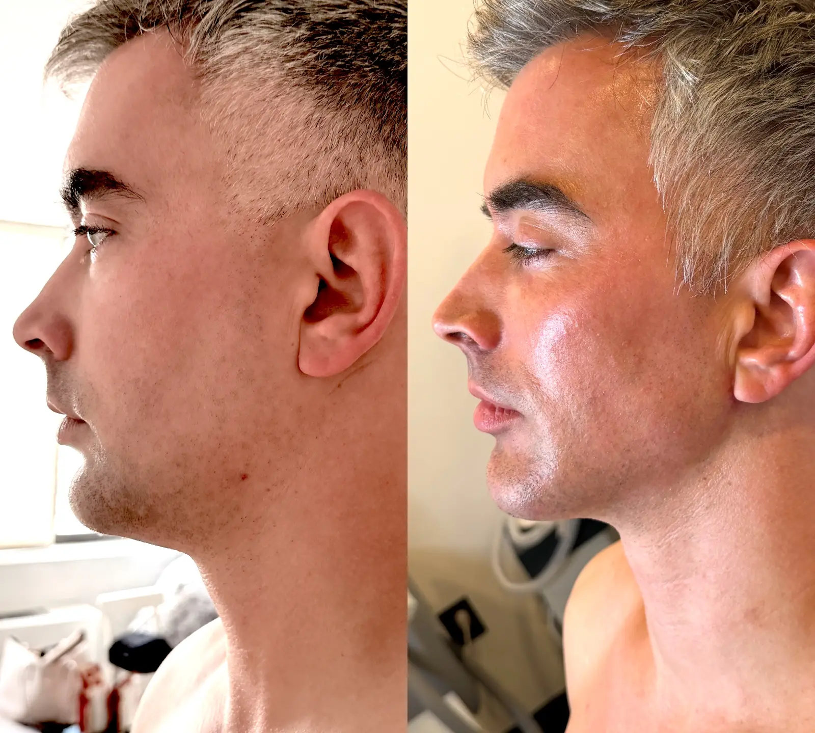 Gregg Starr — Face / left profile from the practice image archive