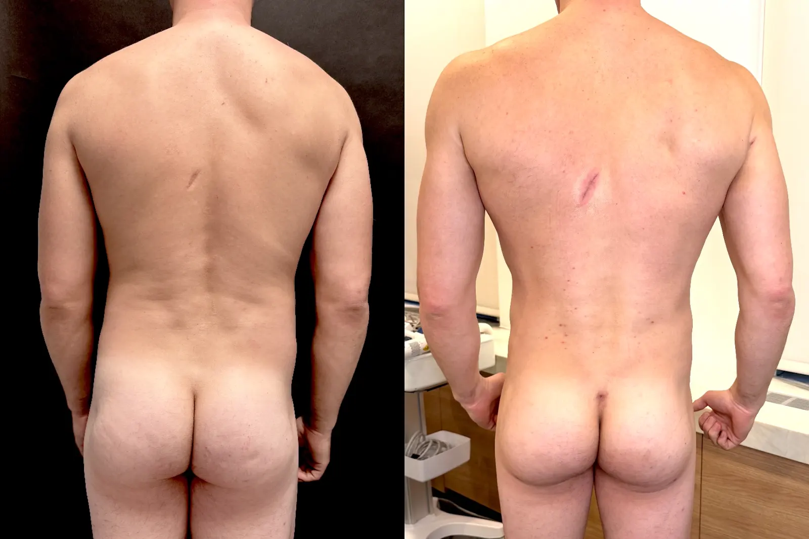 Gregg Starr — Back / posterior view from the practice image archive