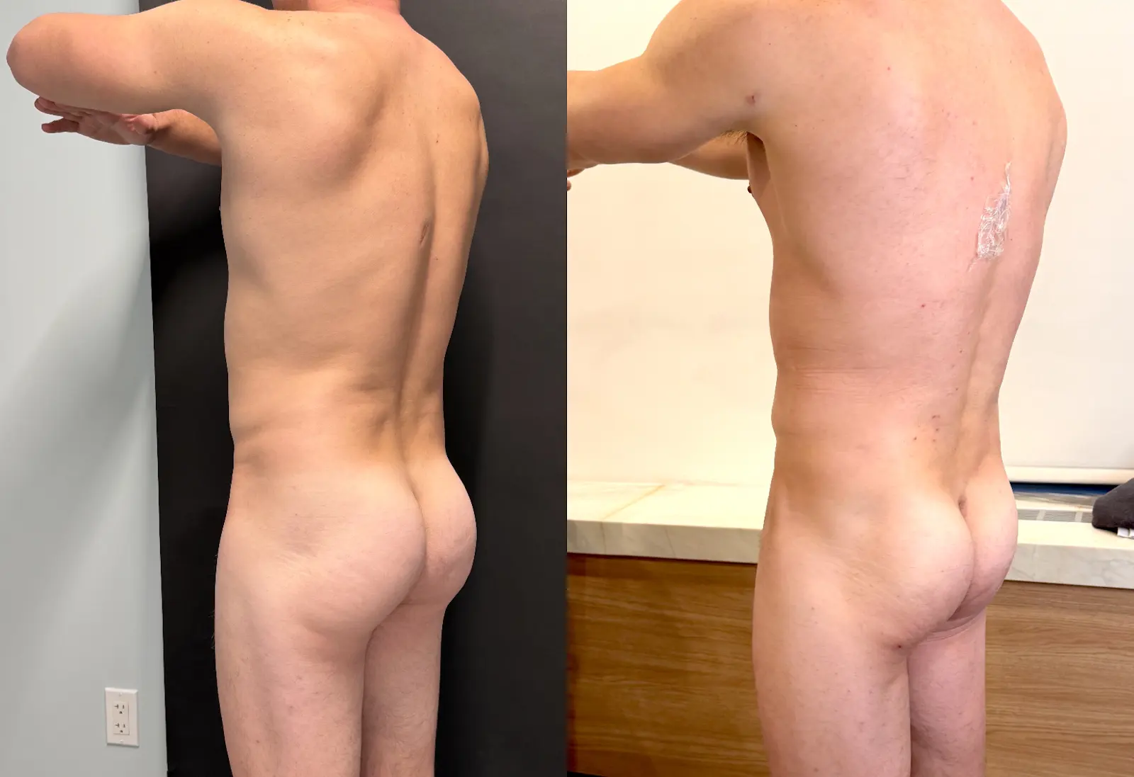 Gregg Starr — Waist / side view from the practice image archive
