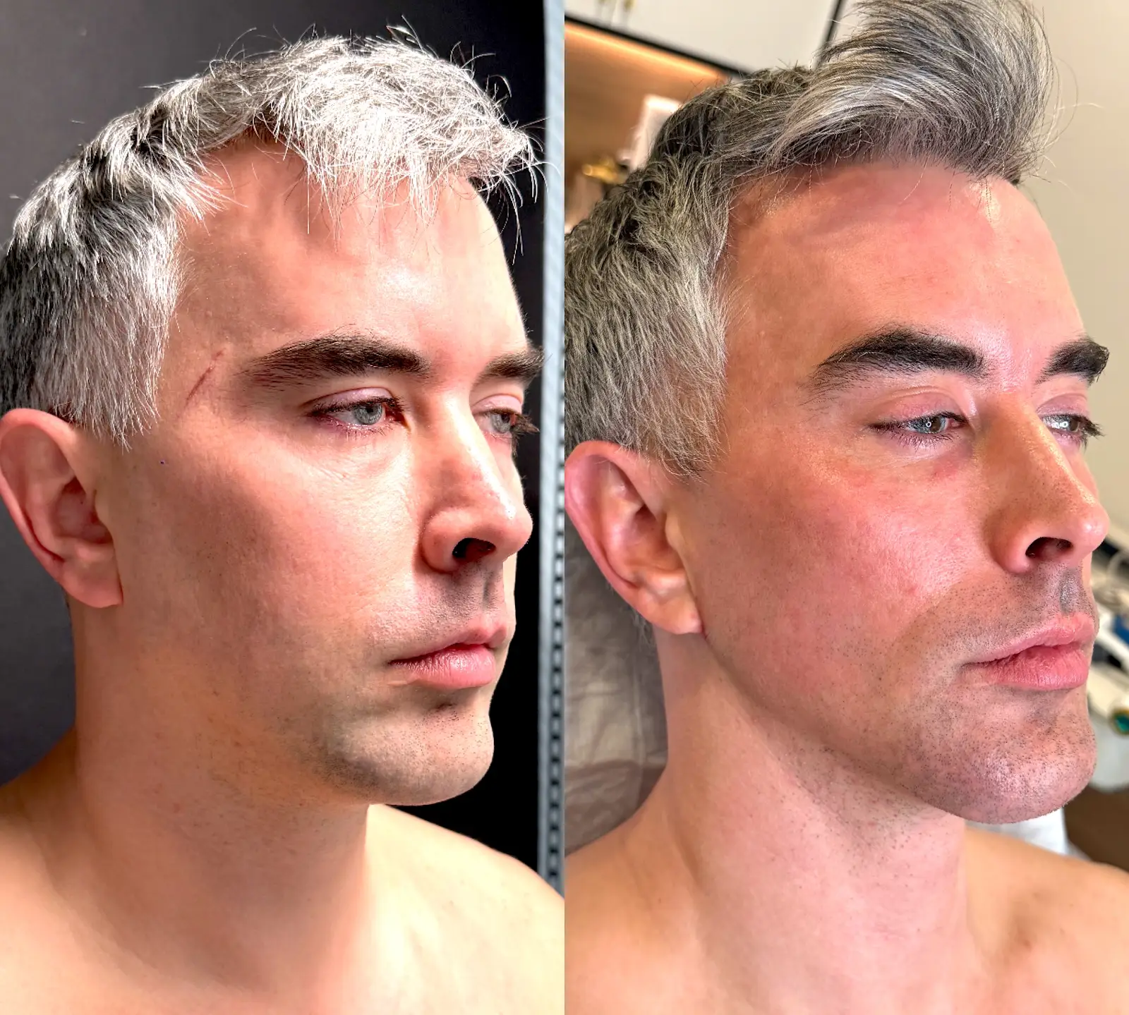 Gregg Starr — Face / three-quarter from the practice image archive