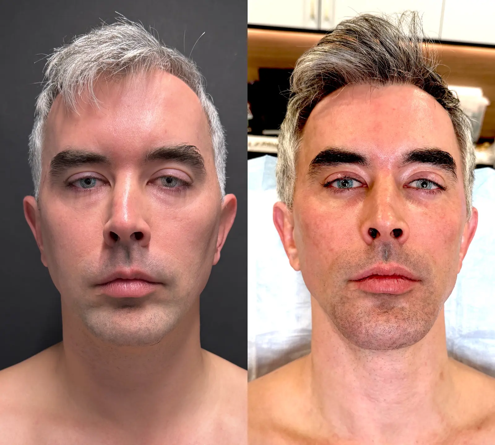 Gregg Starr — Face / frontal from the practice image archive