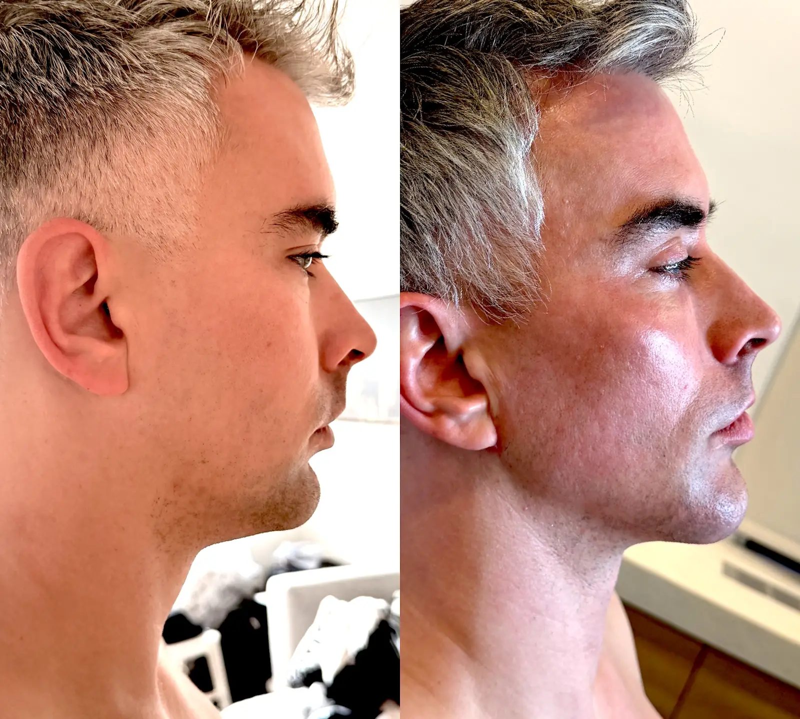 Gregg Starr — Face / right profile from the practice image archive