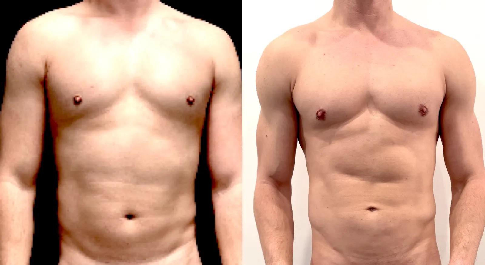 Gregg Starr — Torso / frontal comparison from the practice image archive