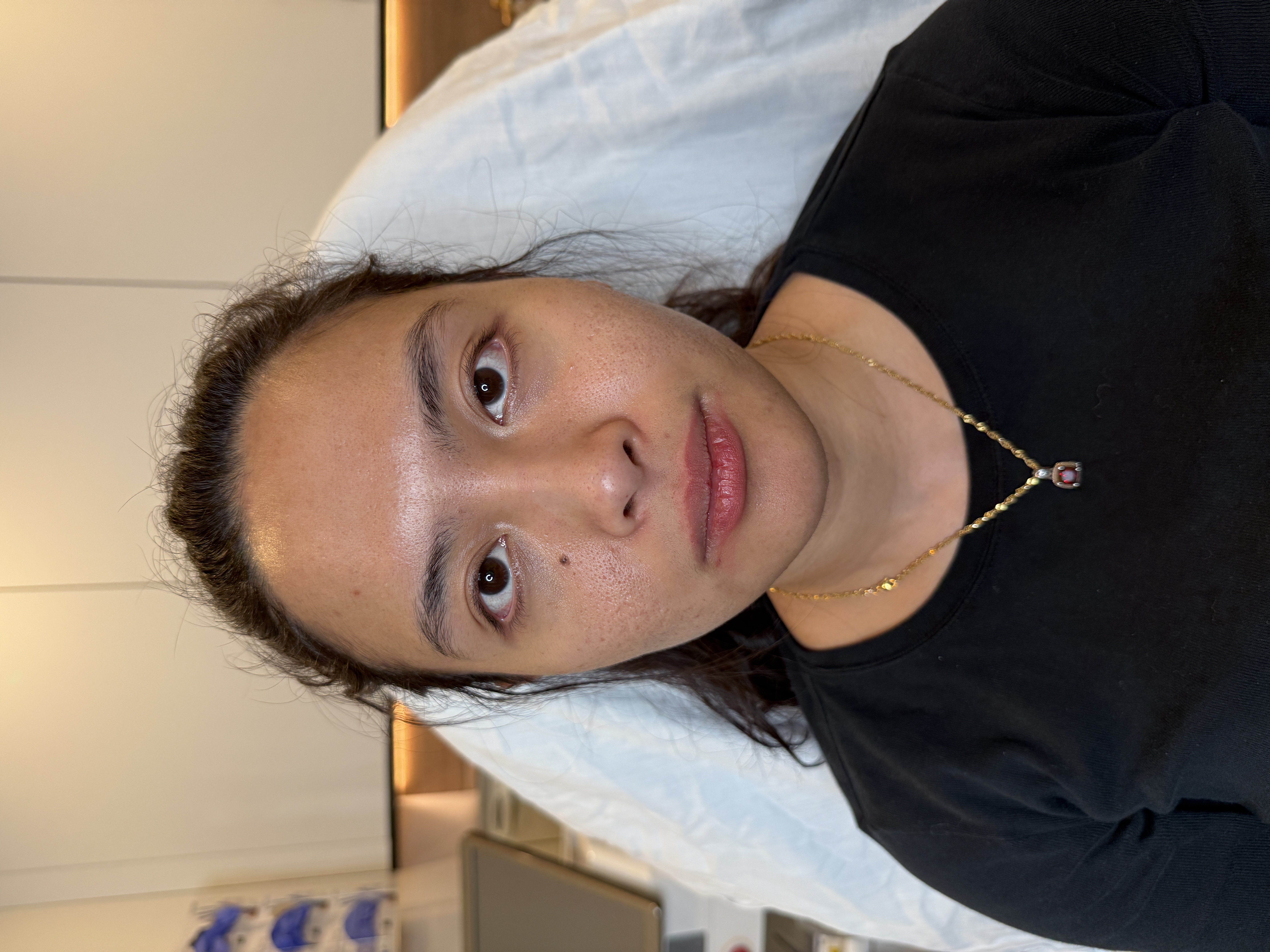 KIMBERLY / OCTOBER 2025: Before. Before treatment.