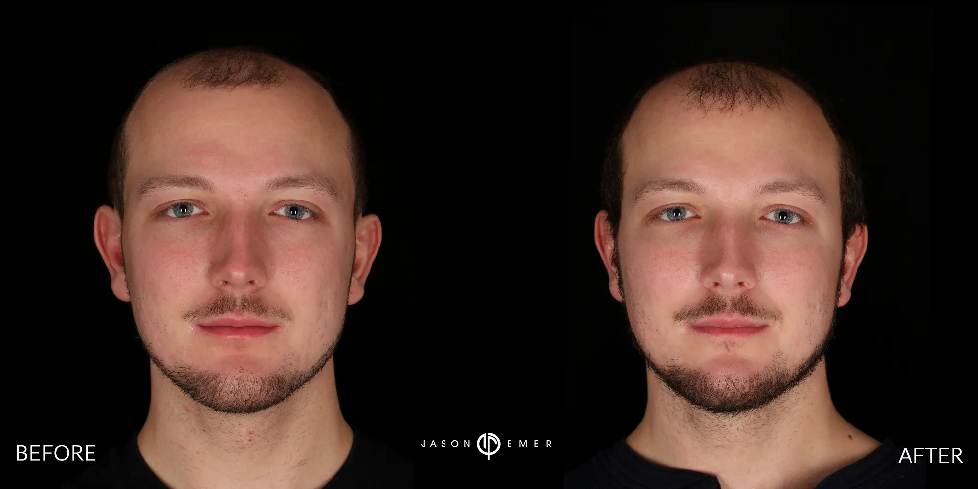 Patient photo