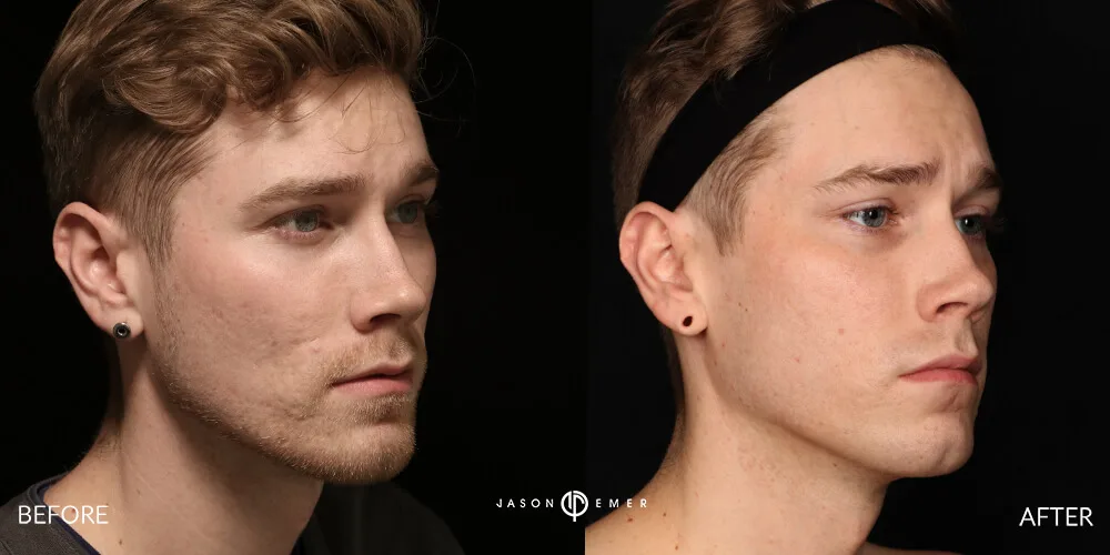 colton2