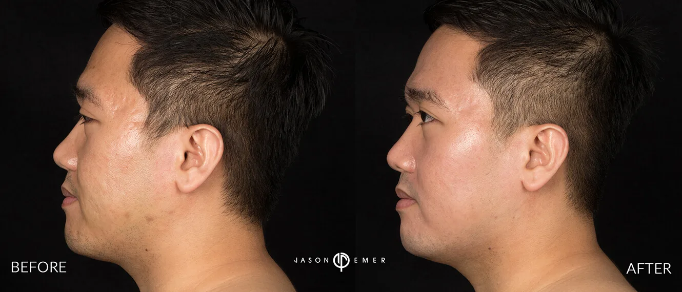 Patient photo