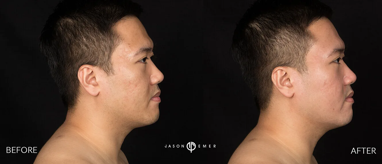 Patient photo