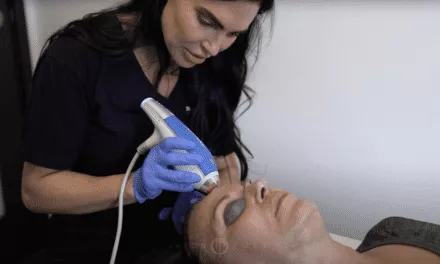 CLEAR AND BRILLIANT WITH MICRONEEDLING AND PRP EXPLAINED
