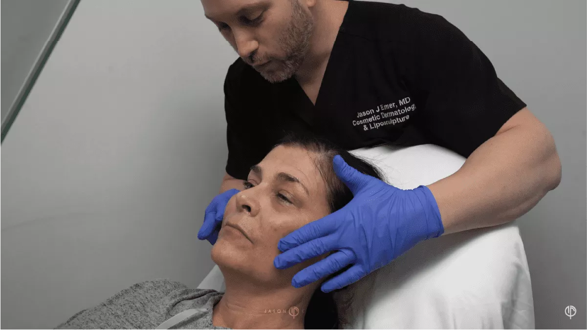 FEMALE FACIAL SCULPTING OF THE CHEEKS, NASOLABIAL FOLDS AND CHIN WITH FILLERS