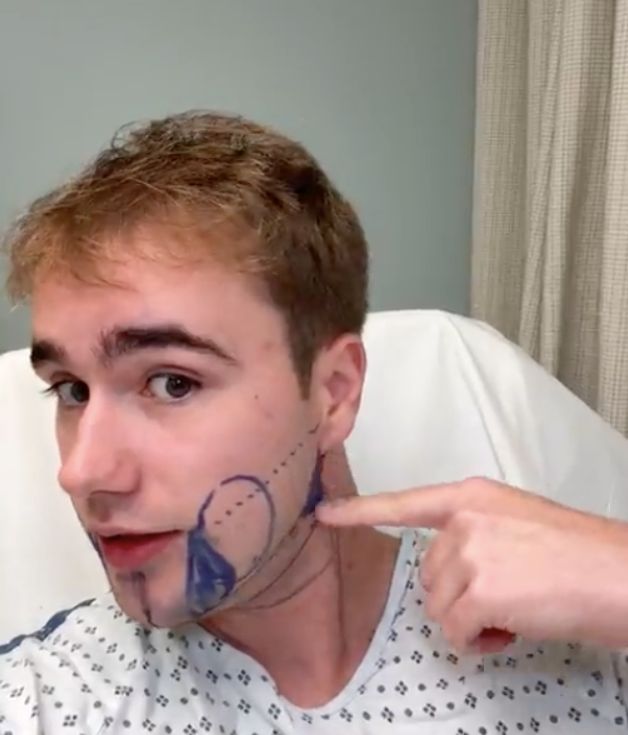 Close-up of proportion lines illustrating attention to detail on the face