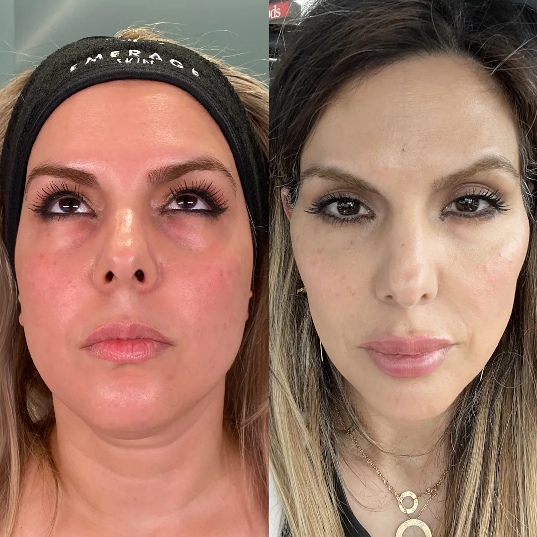 230831_Movahedi_Fereshteh_BA_01
