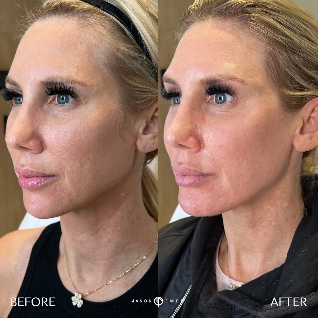 Patient photo