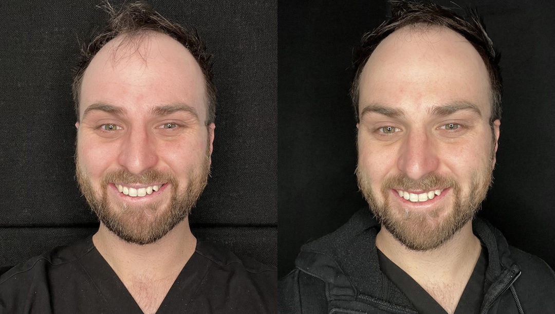 BOTOX-bxa4-1-1080x611